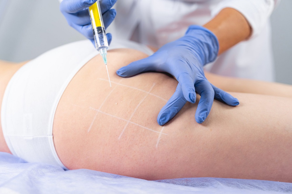 Before You Try Fat Reduction Injections: What To Know