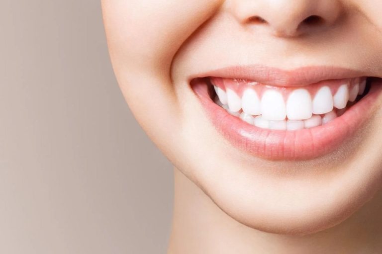 Teeth Whitening: All You Need To Know About The Procedure