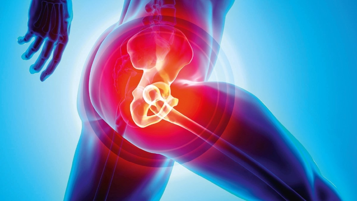 A Complete Guide To Hip Joint Implants