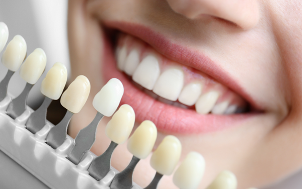 Why Teeth Whitening in Singapore Is Best Done at a Dental Clinic in Orchard